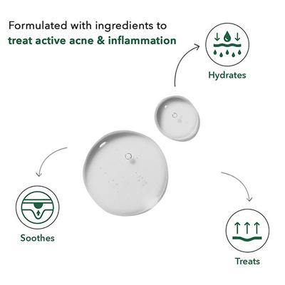 Be Soulfull Acne Control Serum 30 ml - Face Serum