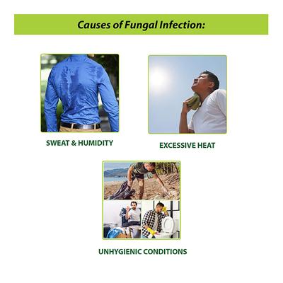 Tetmosol Dusting Powder 100 gm - Itching/Rashes