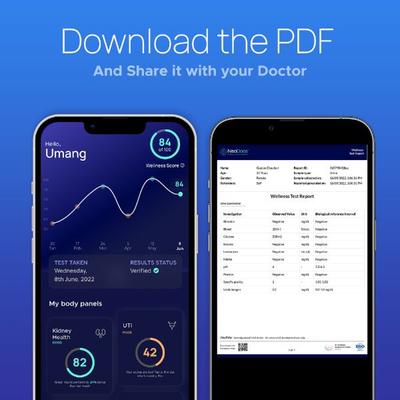 Neodocs Wellness Care Instant Urine Test Kit - Health Monitors And Equipment