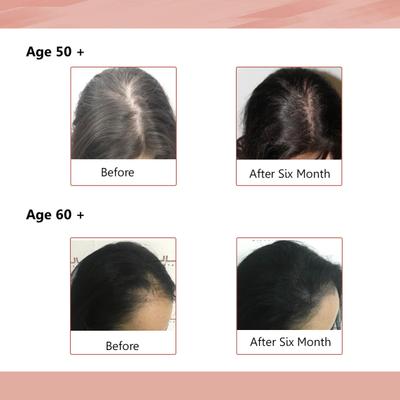 Sheneed Hair Supplement Capsule 60's + Skin Vitamins Capsule 60's - Hair & Skin