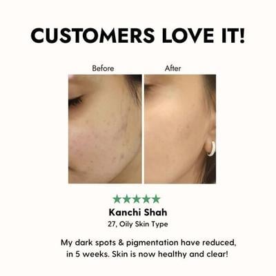 Kapiva Skin Foods Glow Mix Powder 108 gm - Personal Care (Ayush)