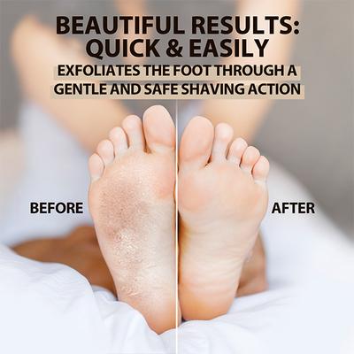 LetsShave Evior Callus Foot Shaver - Women 5's - Shaving & Hair Removal