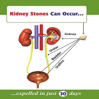 Bal Vedics Stonex Capsule (Pack of 10 X 10's) - Health Products