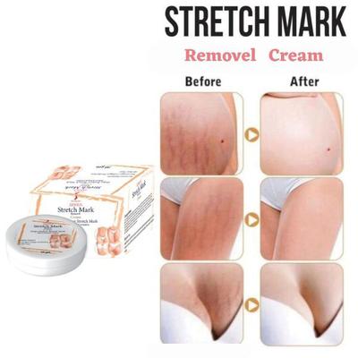 Zenius Stretch Mark Removel Cream 50 gm - Personal Care (Ayush)
