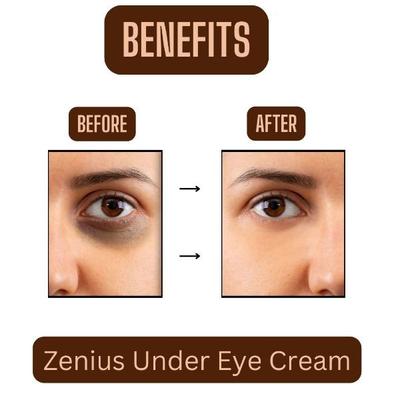 Zenius U Eye Whitening Cream 50 gm - Personal Care (Ayush)