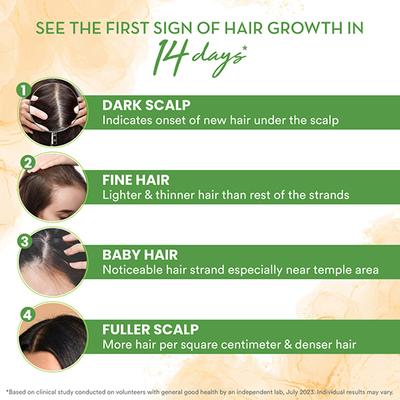 WOW Skin Science Rosemary & Biotin Hair Growth Shampoo 250 ml - Shampoos