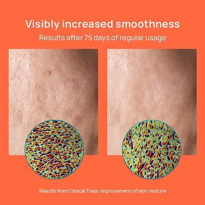 Nyumi Radian Skin Gummies 250 gm - Hair & Skin