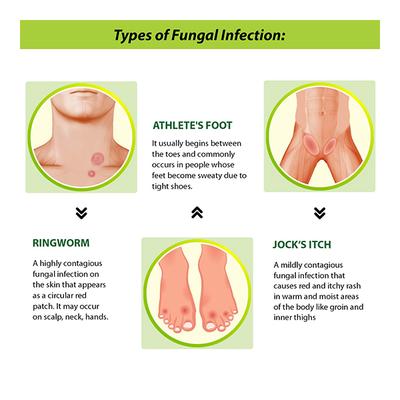 Tetmosol Dusting Powder 100 gm - Itching/Rashes