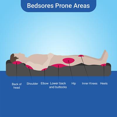 Amaterasu Soreze Gel (Pack of 3 x 30 gm) 1's - Lotions & Creams