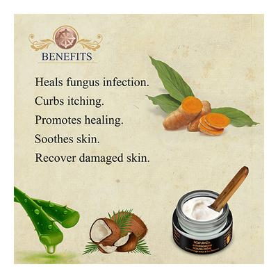 Bioayurveda Anti-Ringworm Healing Creme 20 gm - Skin-Treatment