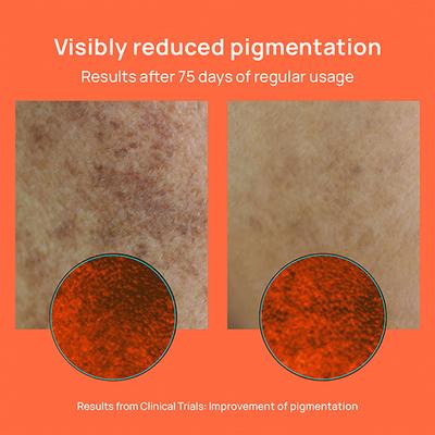 Nyumi Radian Skin Gummies 250 gm - Hair & Skin