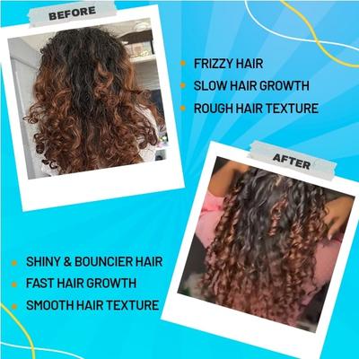 Chicnutrix Bounce - Hair Recovery Complex, Biotin, Selenium Effervescent Tablet - Mango Delight Flavour 20's - Hair & Skin