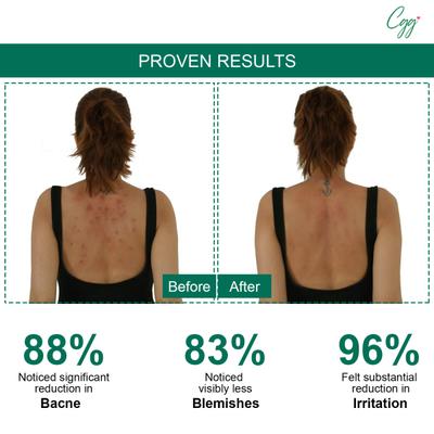 CGG Cosmetics Salicylic Acid Serum - In Body Spray For Backne, Buttne Skin 100 ml - Creams/Oils/Lotions