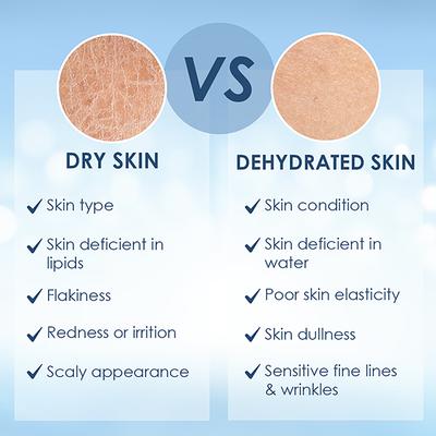 Cetaphil Optimal Hydration Replenishing Body Lotion, Lightweight and Non-Greasy 237 ml - Face Moisturizers