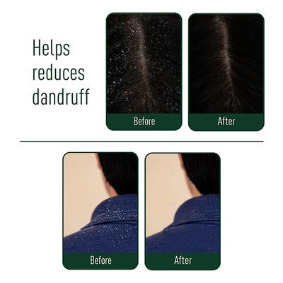 Neem Ayu Effective Ayurveda All Natural Anti Dandruff Capsule 60's - Hair Treatment