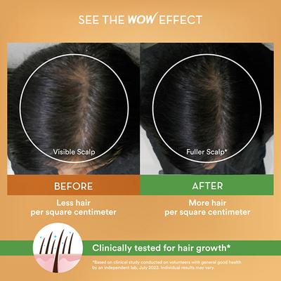 WOW Skin Science Rosemary & Biotin Hair Growth Shampoo 250 ml - Shampoos