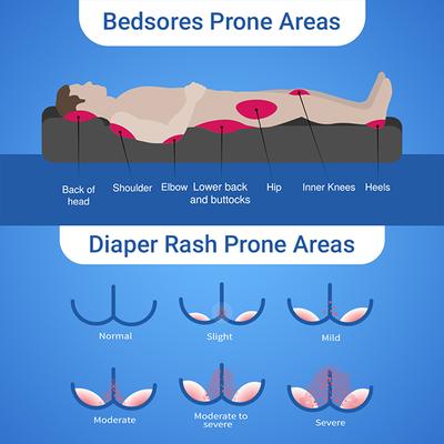 Amaterasu Soreze Spray (Pack of 2 x 50 ml) 1's - Lotions & Creams