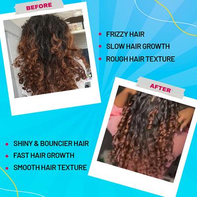 Chicnutrix Bounce - Biotin for Hair Growth with Selenium & Amino Acids - Raspberry Flavour 20 Tablets 1's - Hair & Skin