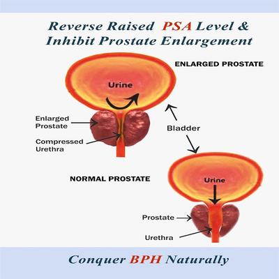Bal Vedics Prostowin Capsule (3 X 10's) - Health Products