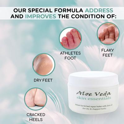 Aloe Veda Kokum Foot & Heel Repair Butter with Clove Oil 100 gm - Essential Oils