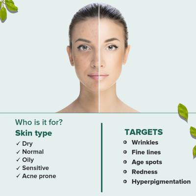 CGG Cosmetics No More Acne 2% Salicylic Serum 10ml + CGG Cosmetics Salicylic Acid Water Gel Moisturizer 50 gm + CGG Cosmetics Ultra Matte Sunscreen Gel SPF 45 Broad Spectrum PA+++ Protection 50 gm (Combo Pack) 160 gm - Body Sunscreen