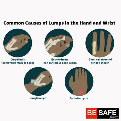 Be Safe Forever Wristband - Black - Hand/Wrist Supports