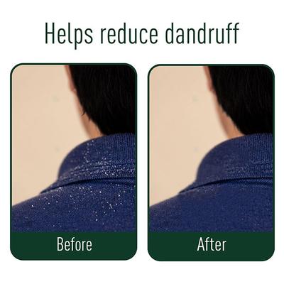 Neem Ayu Anti Dandruff Kit (Anti Dandruff Oil 100 ml + Anti Dandruff Capsule 60's + Anti Dandruff Shampoo 200 ml) - Hair Treatment