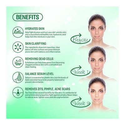 Spantra Cosmetuals Anti-Acne Facial Serum 50 ml - Face Serum