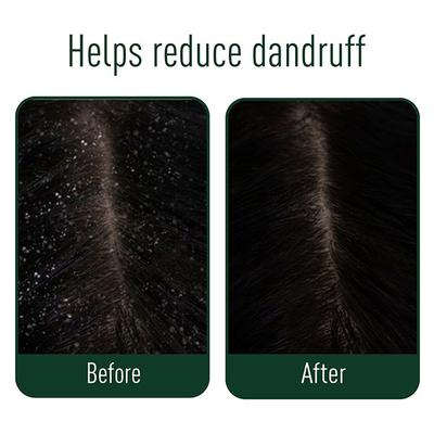 Neem Ayu Anti Dandruff Kit (Anti Dandruff Oil 100 ml + Anti Dandruff Capsule 60's + Anti Dandruff Shampoo 200 ml) - Hair Treatment