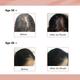 Sheneed Hair Supplement Capsule 60's + Skin Vitamins Capsule 60's - Hair & Skin