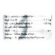 Prebose M SR 0.2/500mg Tablet 10'S - Diabetes-Ant