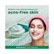 Palmolive Anti Acne Purifying Masque 100 ml - Face Wash & Cleansers
