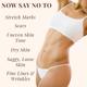 Essentia Extracts Pure Cold Pressed Anti Stretch Marks Oil (Pack of 2 x 100 ml) 1's - Creams/Oils/Lotions