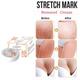 Zenius Stretch Mark Removel Cream 50 gm - Personal Care (Ayush)
