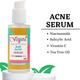 Vigini Natural Actives Anti Acne Serum 30 ml + Anti Acne Gel - Honey and Cinnamon 50 gm - Face Serum