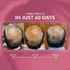 The Herbal Story Hair Growth Oil 50 ml - Hair Oils
