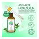 Spantra Cosmetuals Anti-Acne Facial Serum 50 ml - Face Serum