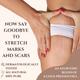 Essentia Extracts Pure Cold Pressed Anti Stretch Marks Oil (Pack of 2 x 100 ml) 1's - Creams/Oils/Lotions