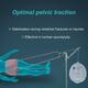 Tynor Pelvic Traction Belt (S) (G 06) - Abdomen/Neck/Arm/Elbow Supports