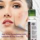 Aloe Veda Anti-Acne Face Wash 100 ml - Face Wash & Cleansers