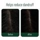 Neem Ayu Anti Dandruff Kit (Anti Dandruff Oil 100 ml + Anti Dandruff Capsule 60's + Anti Dandruff Shampoo 200 ml) - Hair Treatment